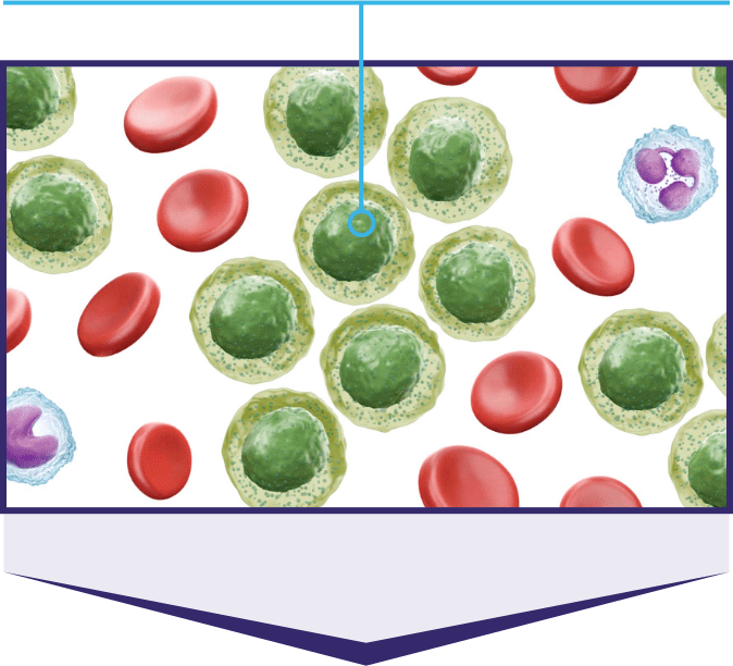 Representation of FLT3-ITD+ AML cancer cells quickly growing and dividing